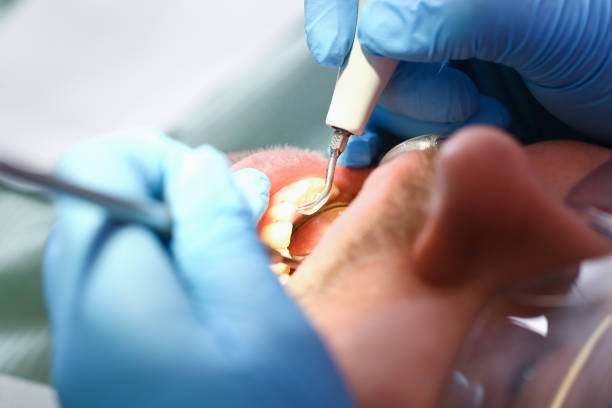 Best Emergency Denture Repair in Hawthorne, FL