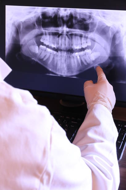 Best Emergency Wisdom Teeth Removal in Hawthorne, FL