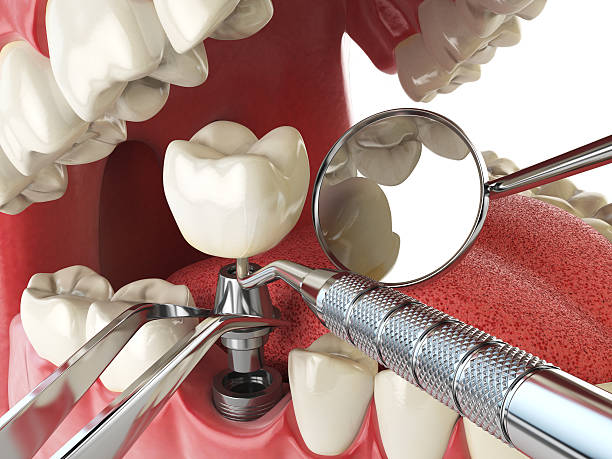 Best Emergency Gum Treatment in Hawthorne, FL